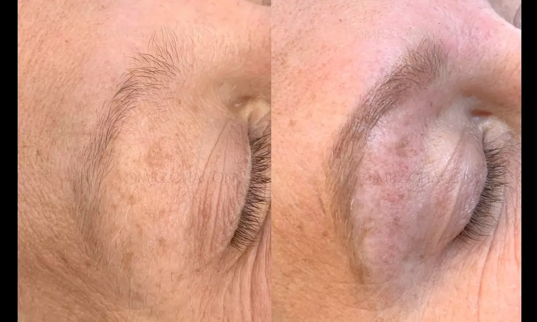 IluVu offers a Brow Wax and Tint service, including measuring, tinting, shaping for up to 50% off - Second Medium
