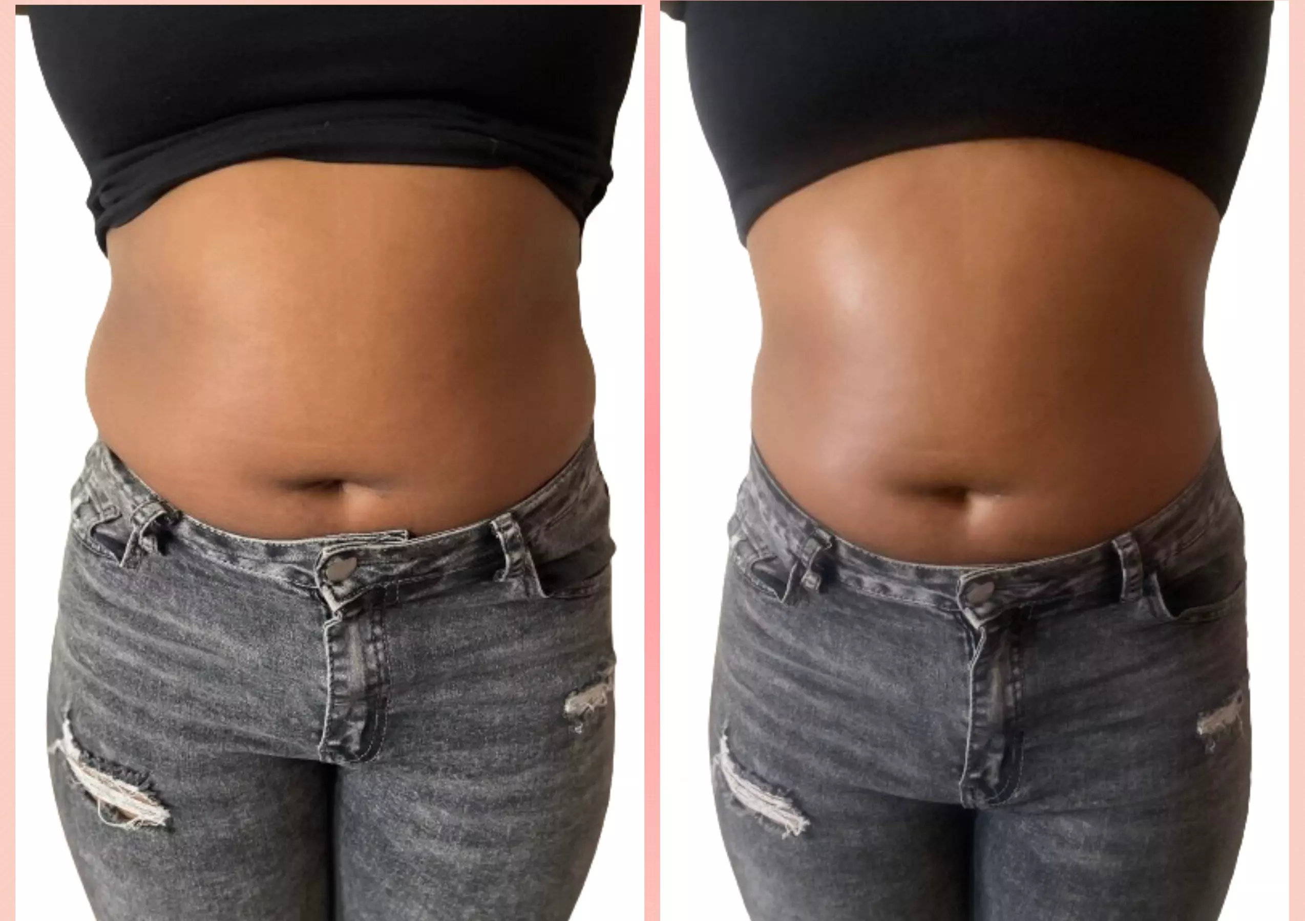 Experience Sa Renity Essentials' Ultrasonic Fat Reduction with up to 50% off, featuring various sculpting options. - Primary Image
