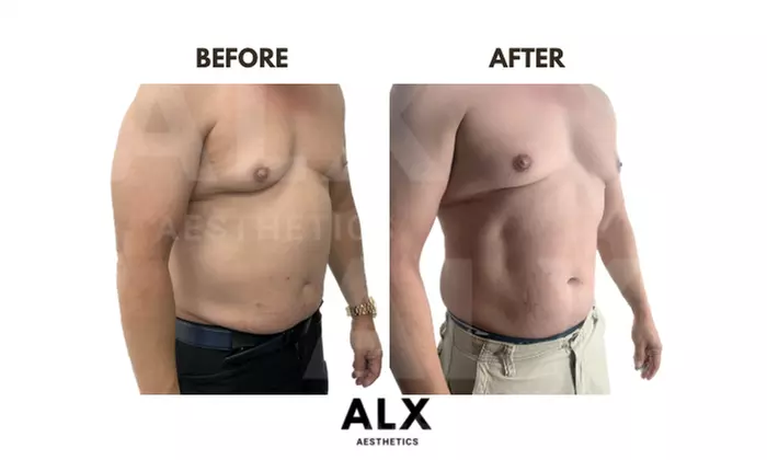 Up to 67% Off on Weight Loss Program / Center at ALX Aesthetics - Primary Image