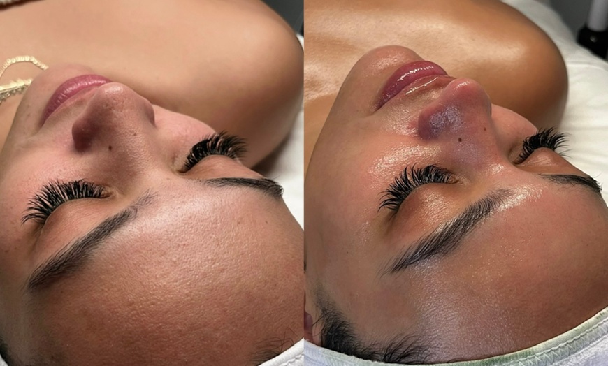 Image 1: Up to 46% Off on Spa / Salon Beauty Treatments at Bella Cera