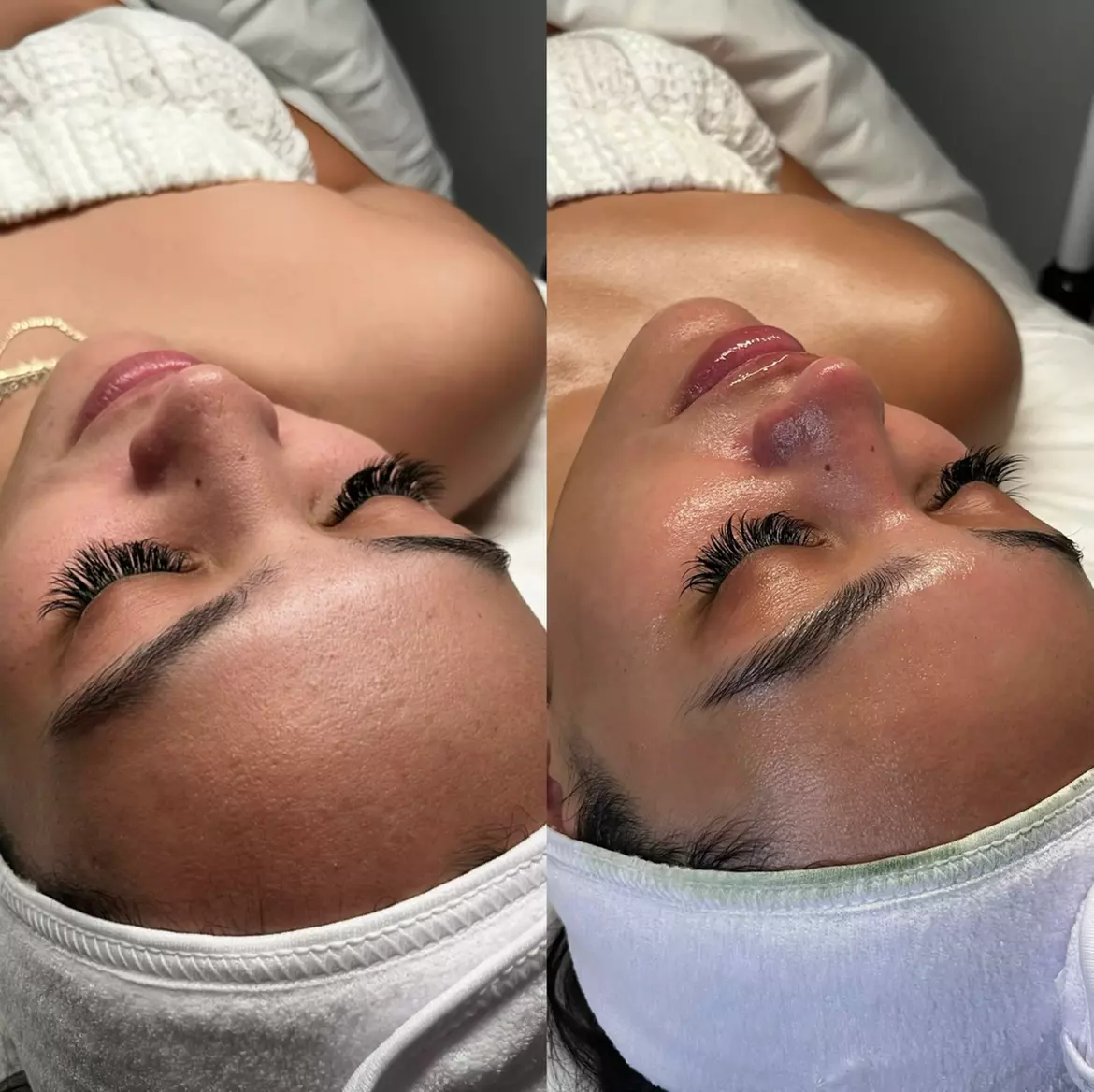 90-Minute Refresh & Revive or Hydrofacial at Bella Cera (Up to 30% Off) - Primary Image