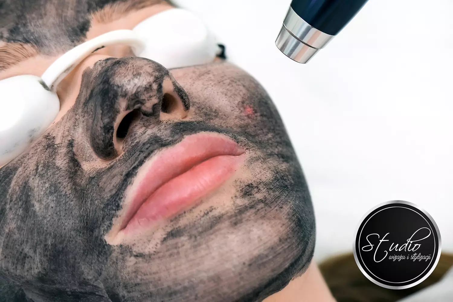 Laserowy peeling węglowy