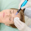 Image 3: Up to 37% Off on micro needling and advanced skin treatments