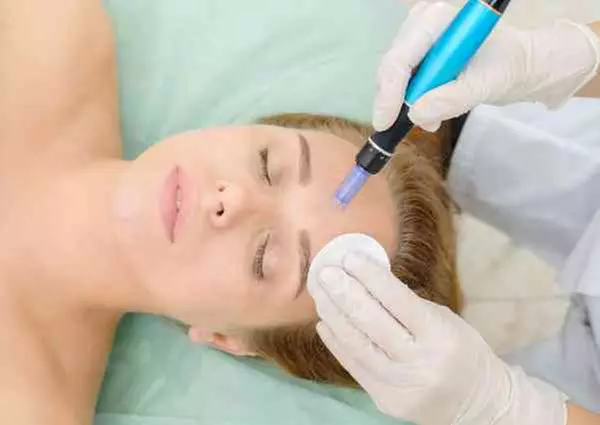 Up to 37% Off on micro needling and advanced skin treatments