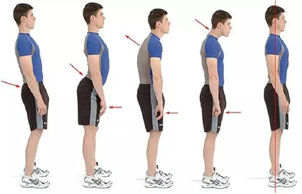 Deep Tissue Massages with Cupping & Postural Correction Up to 70% Off