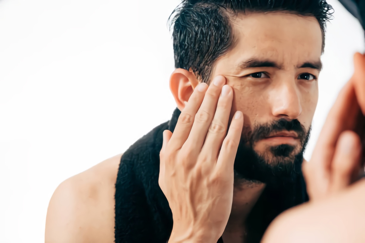 Experience Smooth Skin with 60 or 90 Units of Dysport Injections