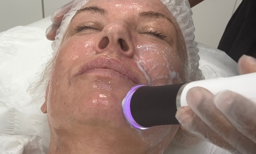 Image 2: Unleash Radiance: Omega Hydro Facial Peel with LED 1 or 3 Sessions