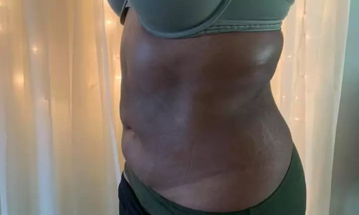 Jumpstart Your Weight Loss This Holiday Season
