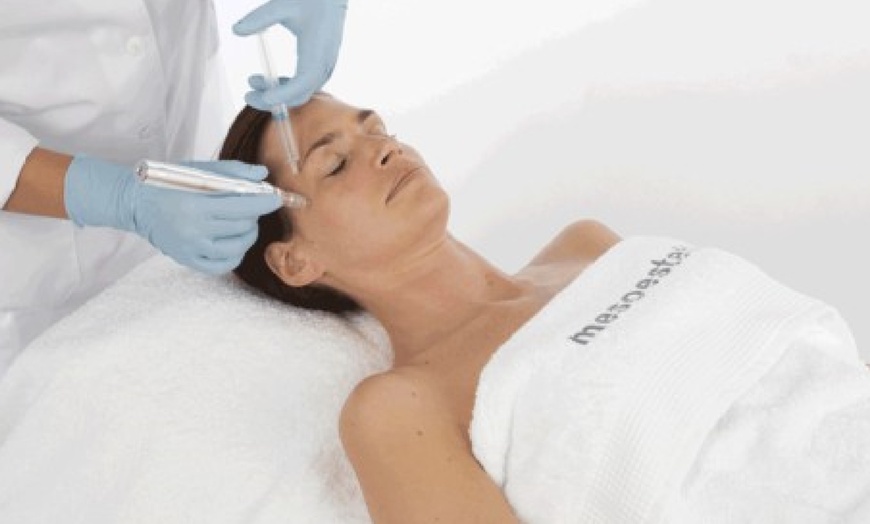 Image 1: Up to 65% Off on  Mesoestetic Microneedling  at Zen Beauty Ltd