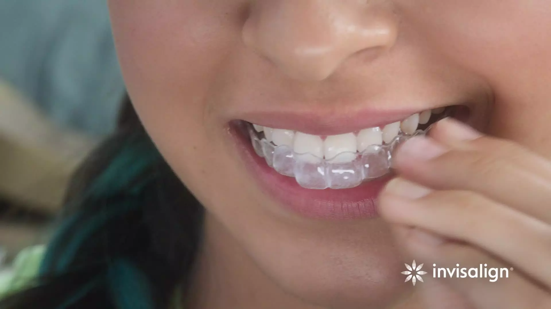 Up to 99% Off on Invisalign at Cityplace Dental Group - Primary Image