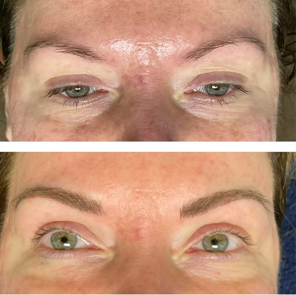 Enhance Your Eyebrows with a Full Microblading Session