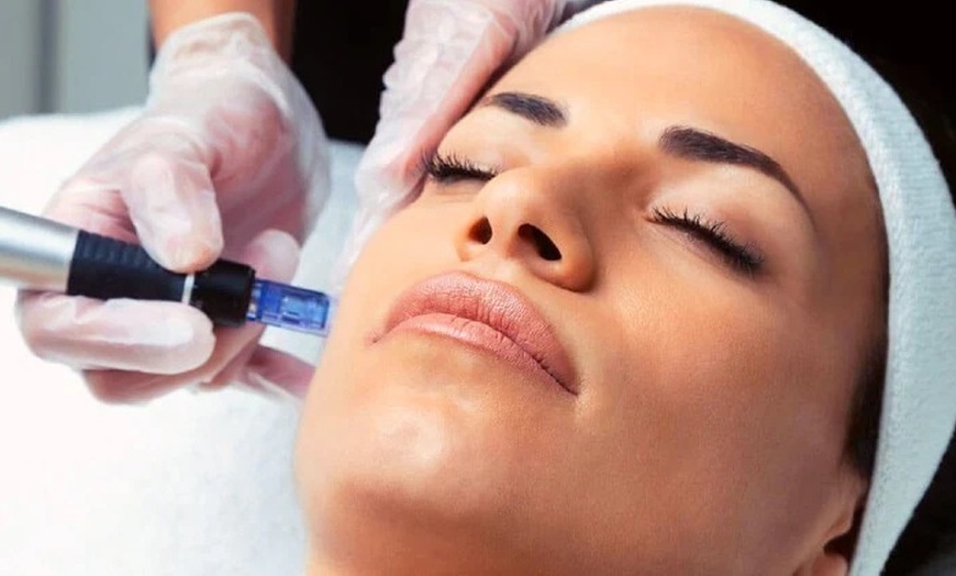 Image 1: Micro Needling Sessions with LED and Collagen Mask Treatments