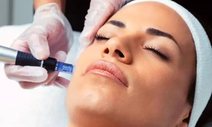 Micro Needling Sessions with LED and Collagen Mask Treatments