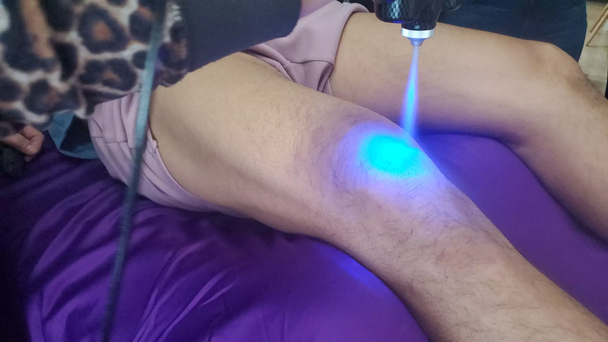 Targeted Localized Cryotherapy for Pain & Recovery