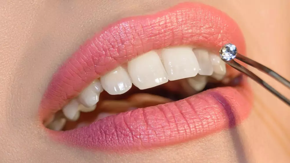 Up to 70% Off on Teeth Whitening at Roya Aflatooni DDS Inc - Primary Image