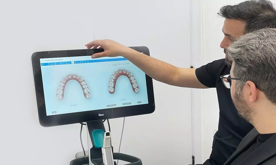 Up to 90% Off on Invisalign Spark/Braces Offer at Thousand Smiles - Primary Image