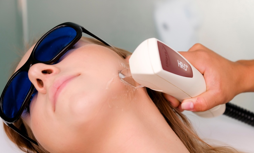 Image 8: Up to 69% Off on Laser Hair Removal at Derma Solution