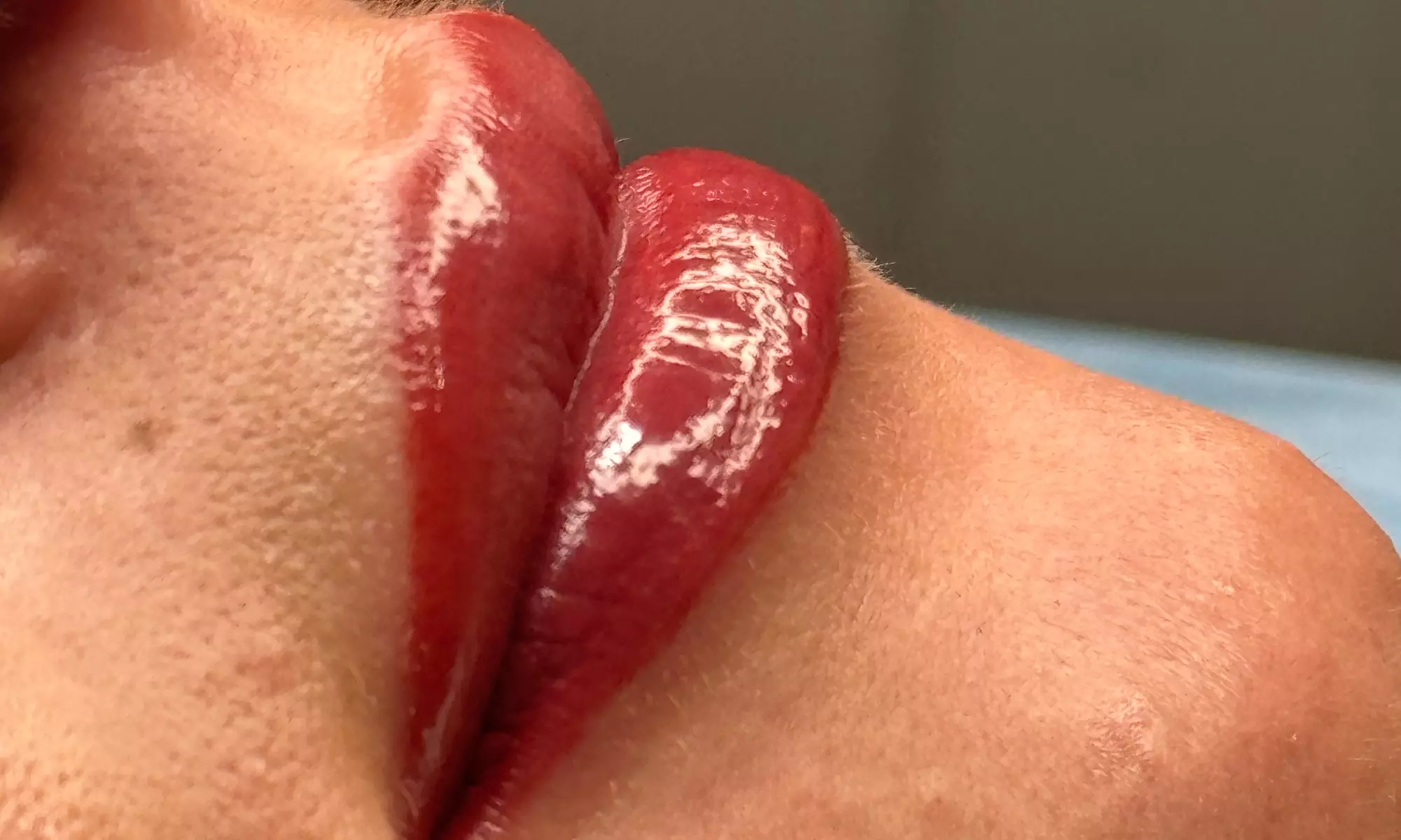 One Micropigmentation Full Lips or Two Lips Full Color Micropigmentation Sessions at ROSMIAMI (Up to 52% Off) - Second Medium