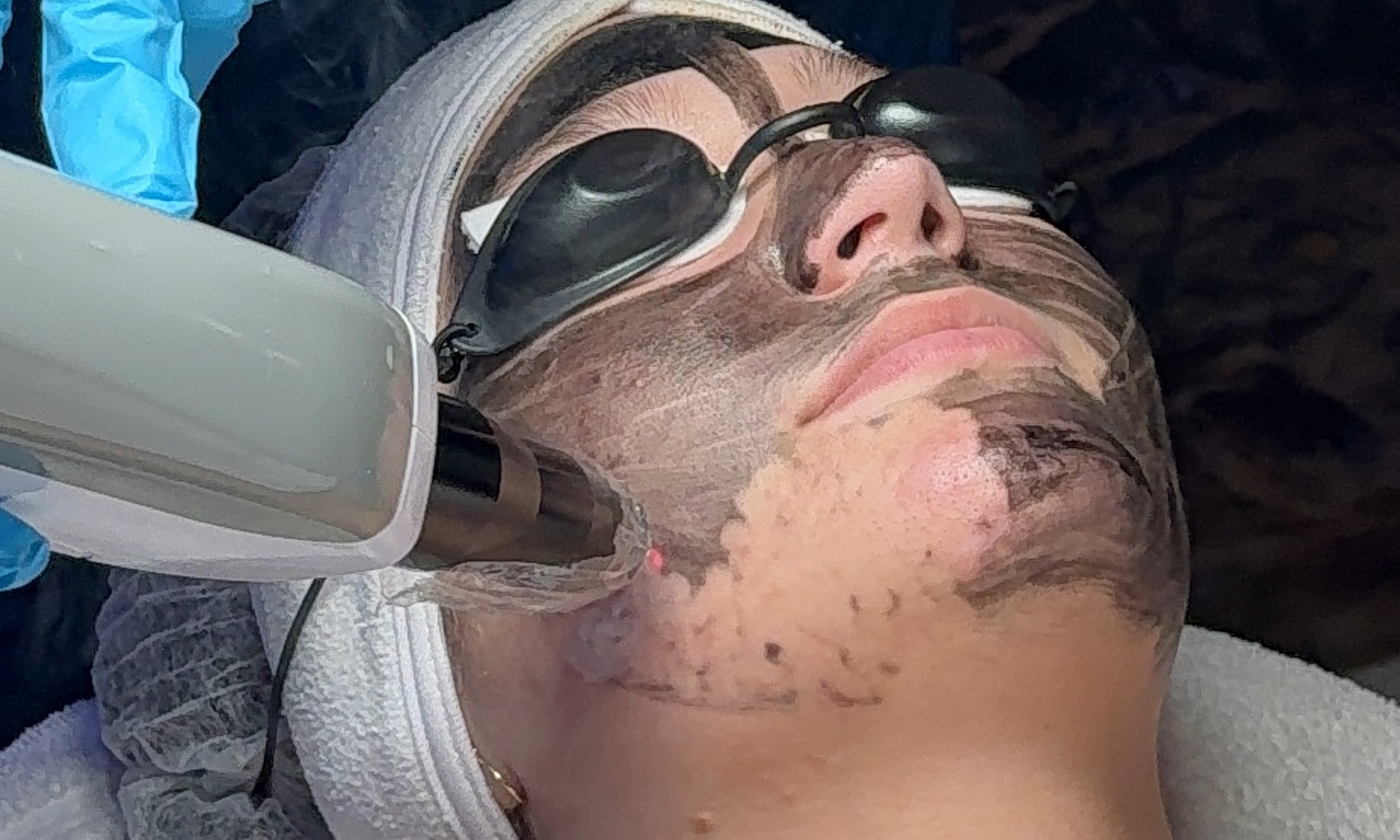 Up to 28% Off on IPL Photo Facial at Erika Cordeiro Estética Facial e Corporal
