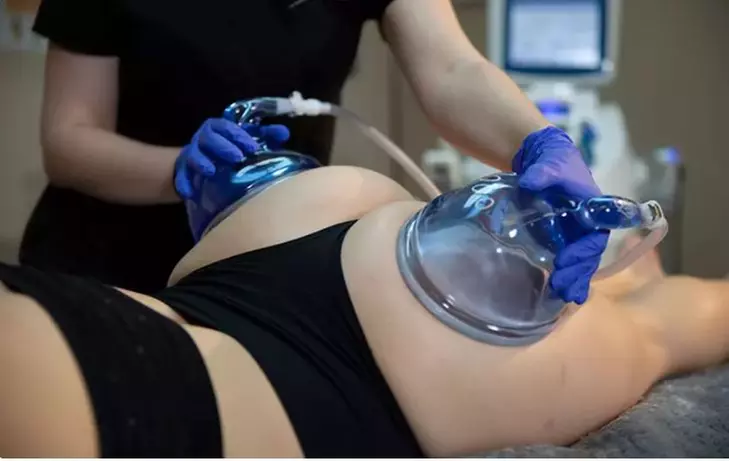 Up to 45% Off on Non-Surgical Butt Lift at Benefit Aesthetics - Primary Image