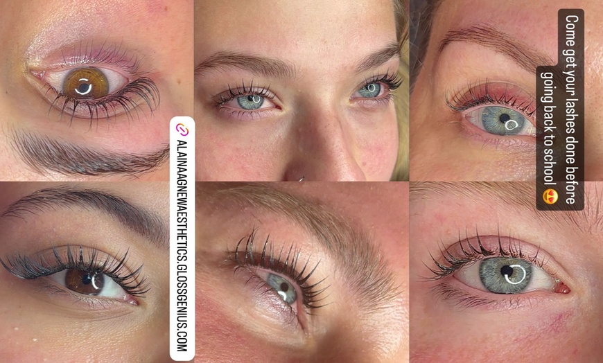 Image 6: Revitalize Your Skin with One or Three Women's Brazilian Waxing
