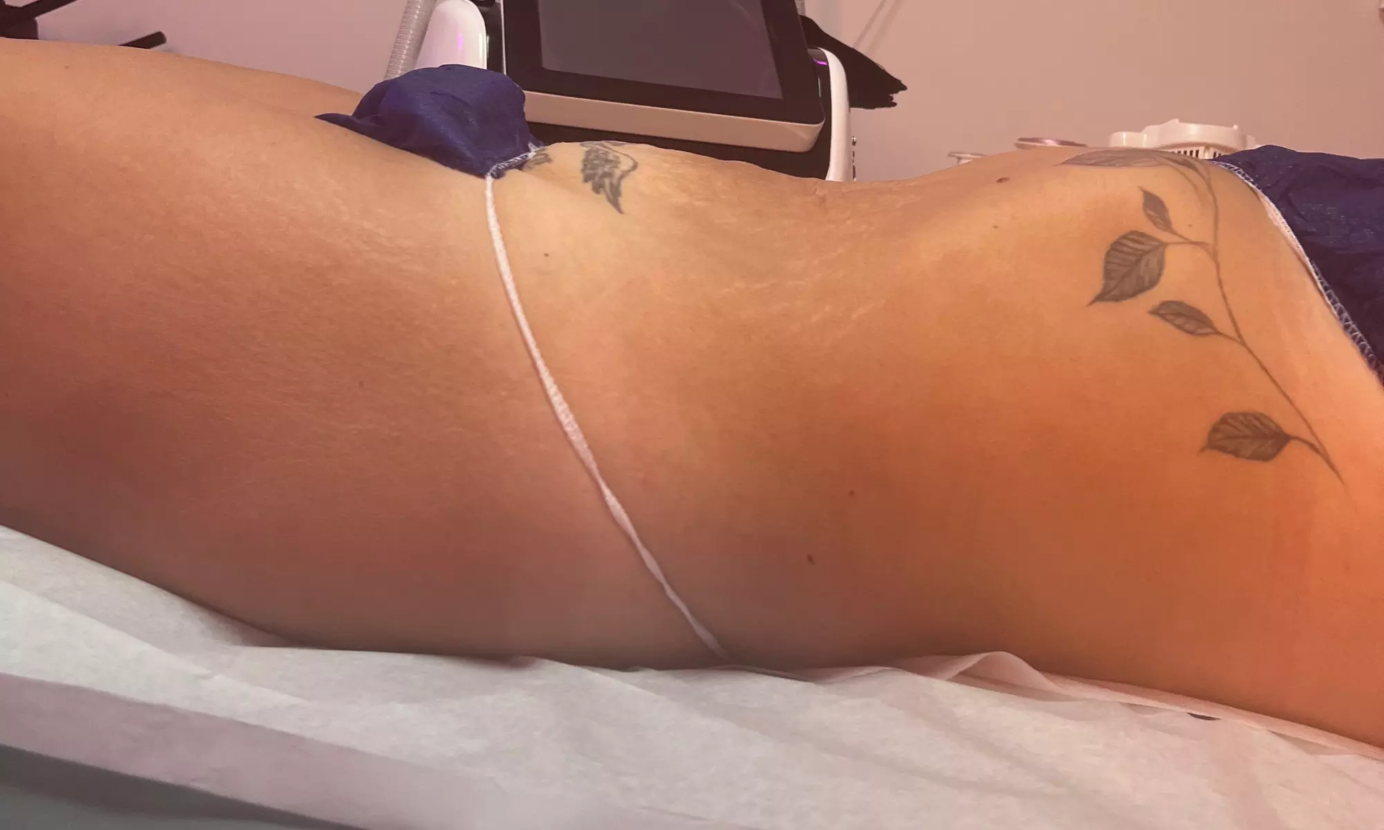 Enhance your curves with Carolina Barbie Dolls LLC's Colombian vacuum butt-lift sessions, offering up to 40% off - Image 3