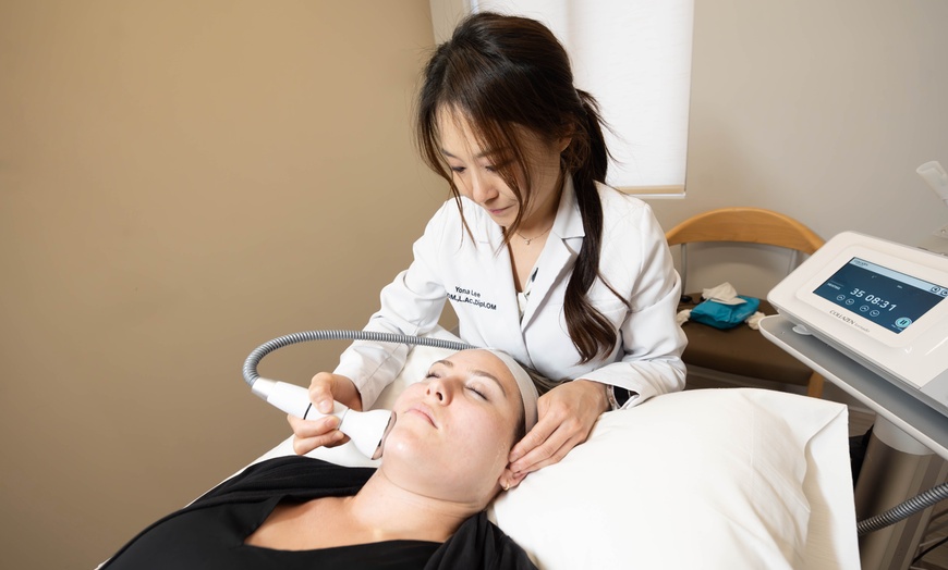 Image 8:  Up to 50% Off on Acupuncture at VUIM clinic and whole health