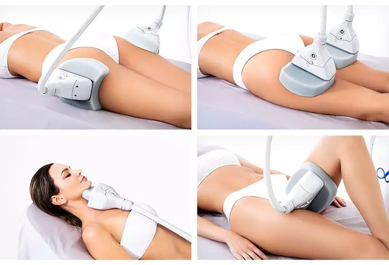 Achieve Body Contouring with Cryolipolysis