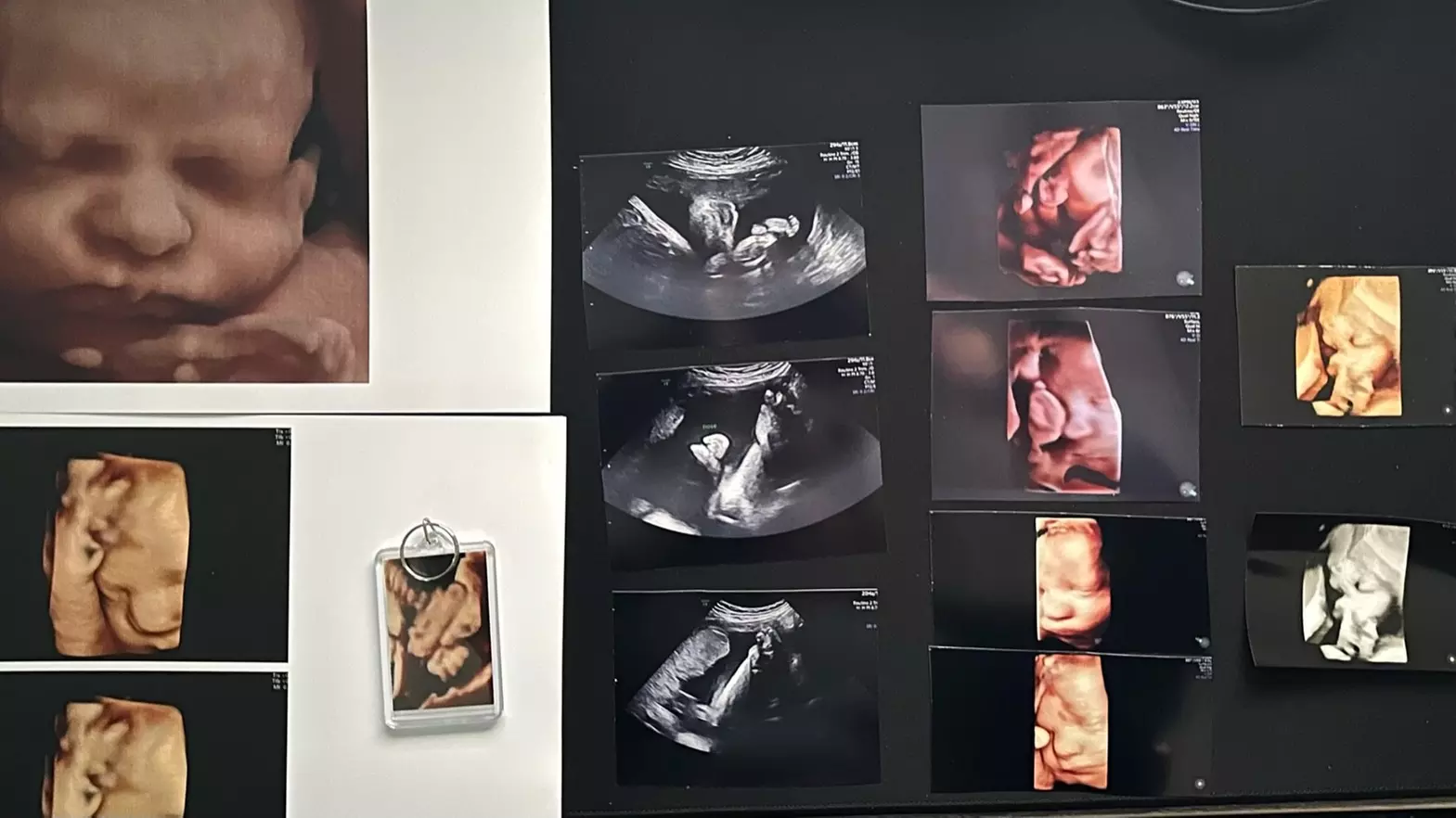 Up to 37% Off on Ultrasound - 3D / 4D at BabySelfie