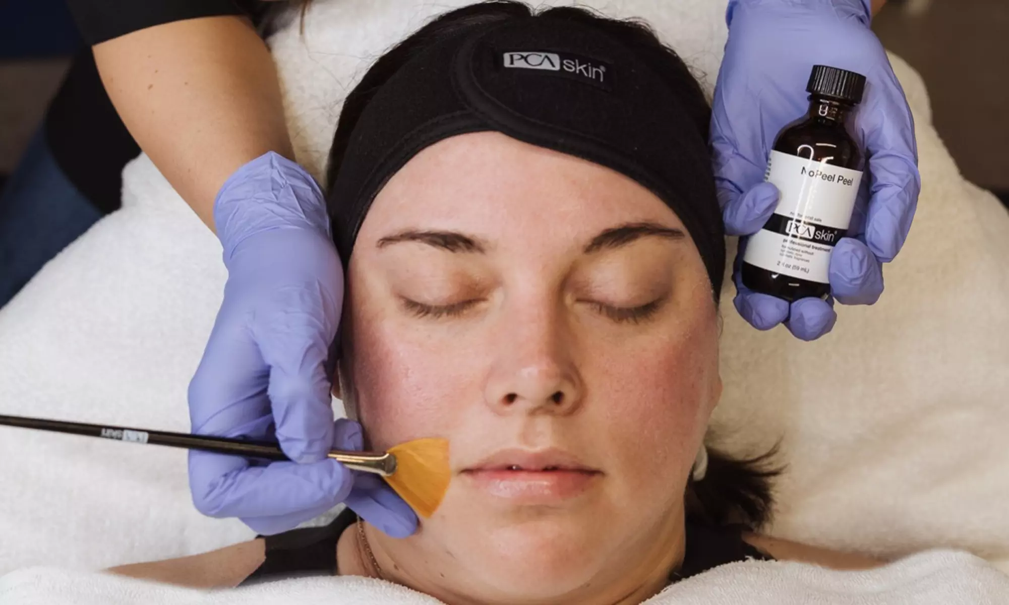 Refresh Your Complexion with PCA Chemical Peels at Goddess Skin Lounge (Up to 50% Off) - Primary Image