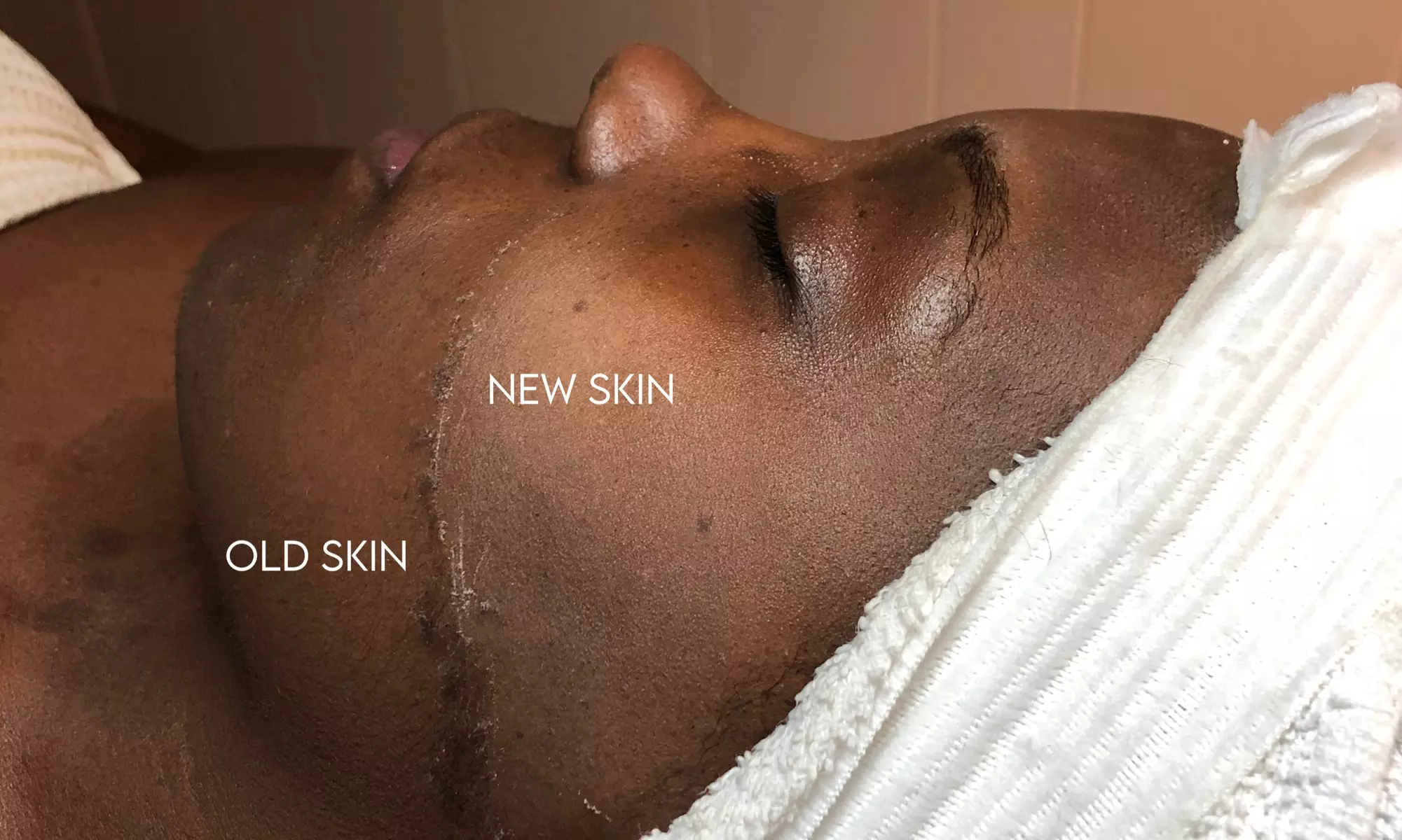 At Renv Nov n Day Spa, enjoy a Refresh Express Facial or Meditation Facial with up to 22% off - Primary Image