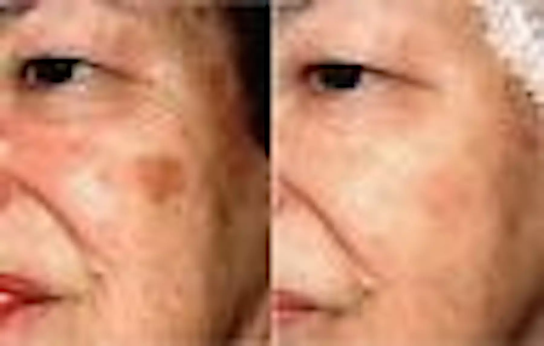 Up to 54% Off on Facial at TRINITYFSA Wellness Beauty Cafe