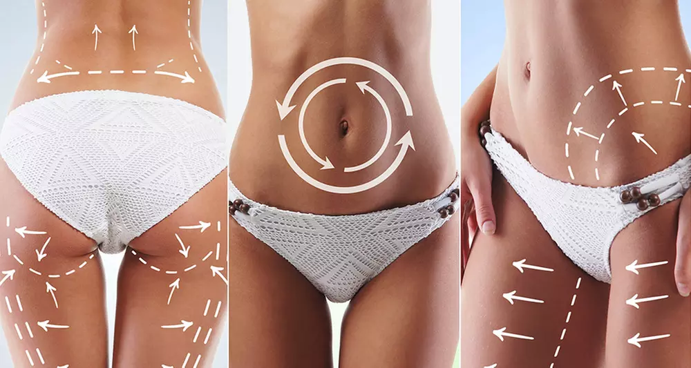 Sculpted Aesthetics offers two or three ultrasonic fat reduction treatments with up to 86% off - Primary Image