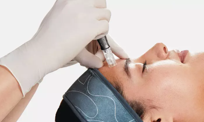 Up to 42% Off on Anti-Aging Facial at The Fix brow bar and skin care studio - Second Medium