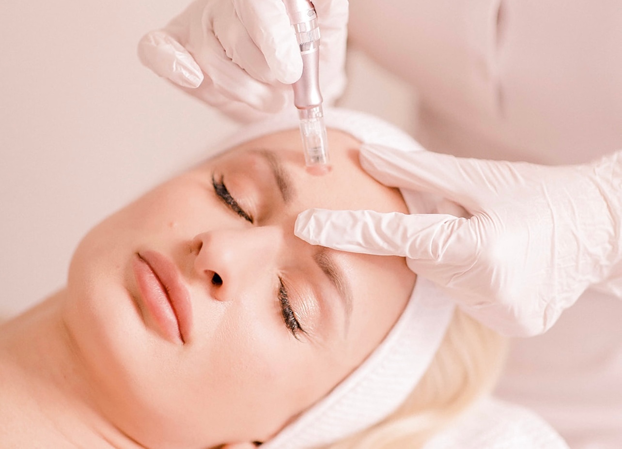 Skin Pen Microneedling with Hyaluronic or Vitamin Infusion