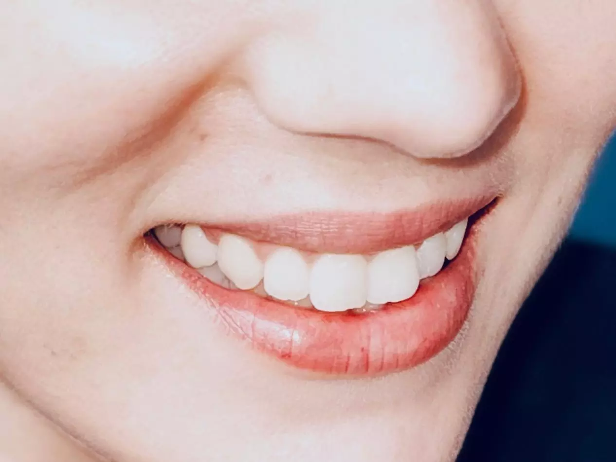 Luce una sonrisa radiante con un examen, diagnóstico y limpieza bucal para 1 persona y ahorra un 80% - Primary Image