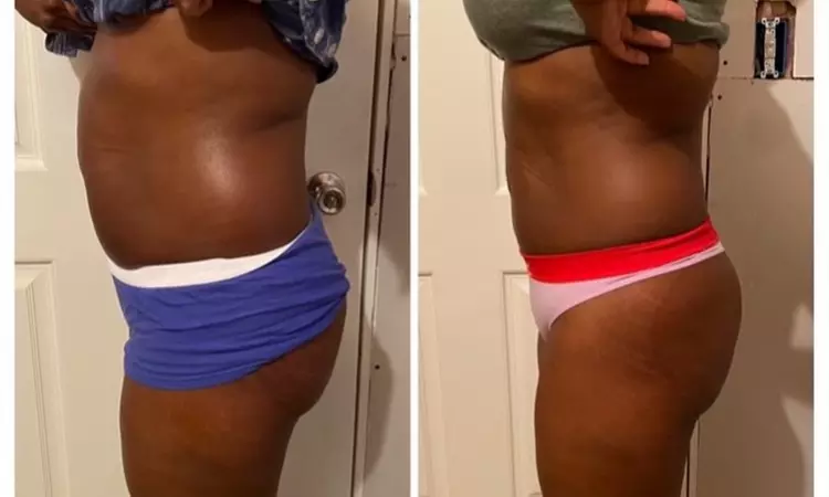 Weight Reduction Program / Center at Pretty Lyfe Esthetics
