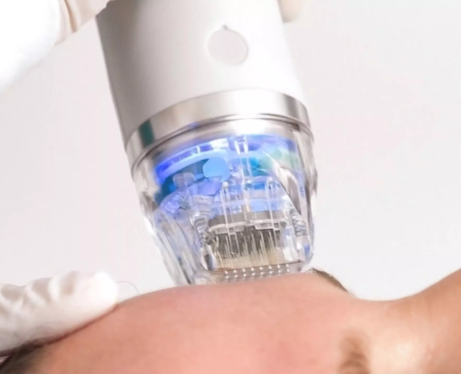 Radiofrekwencja mikroigłowa na twarz, szyję i dekolt dla młodszego wyglądu w Instytucie Estetycznym (do -40%) - Primary Image