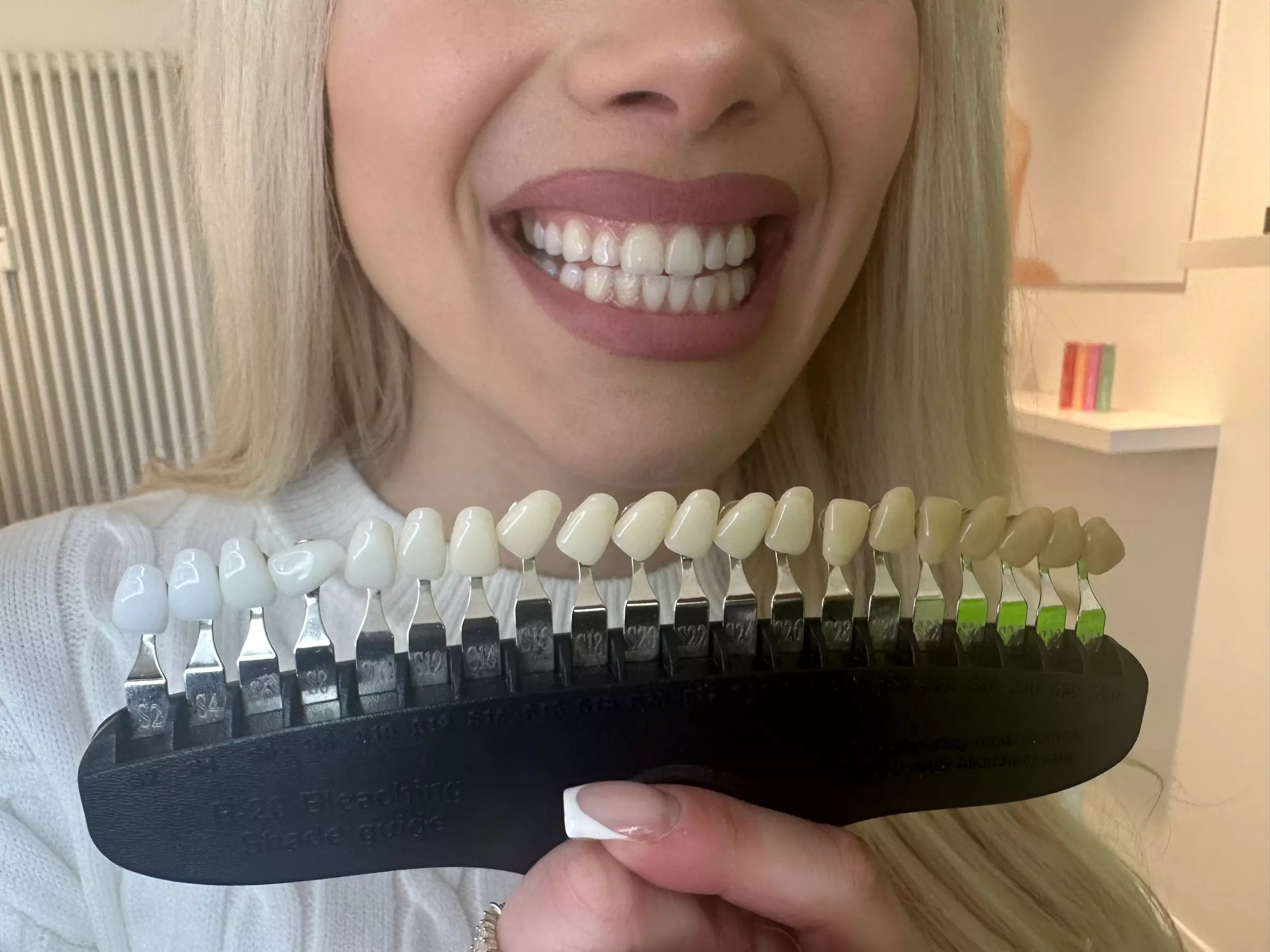 Kosmetisches Zahn-Bleaching