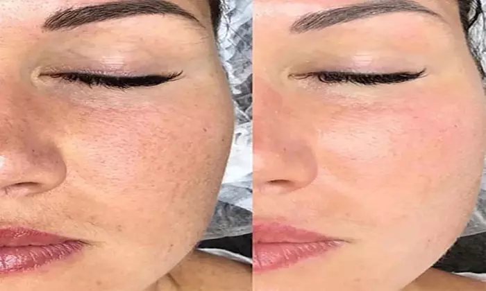 Up to 43% Off on Facial at Beauty on The Beat LLC - Primary Image