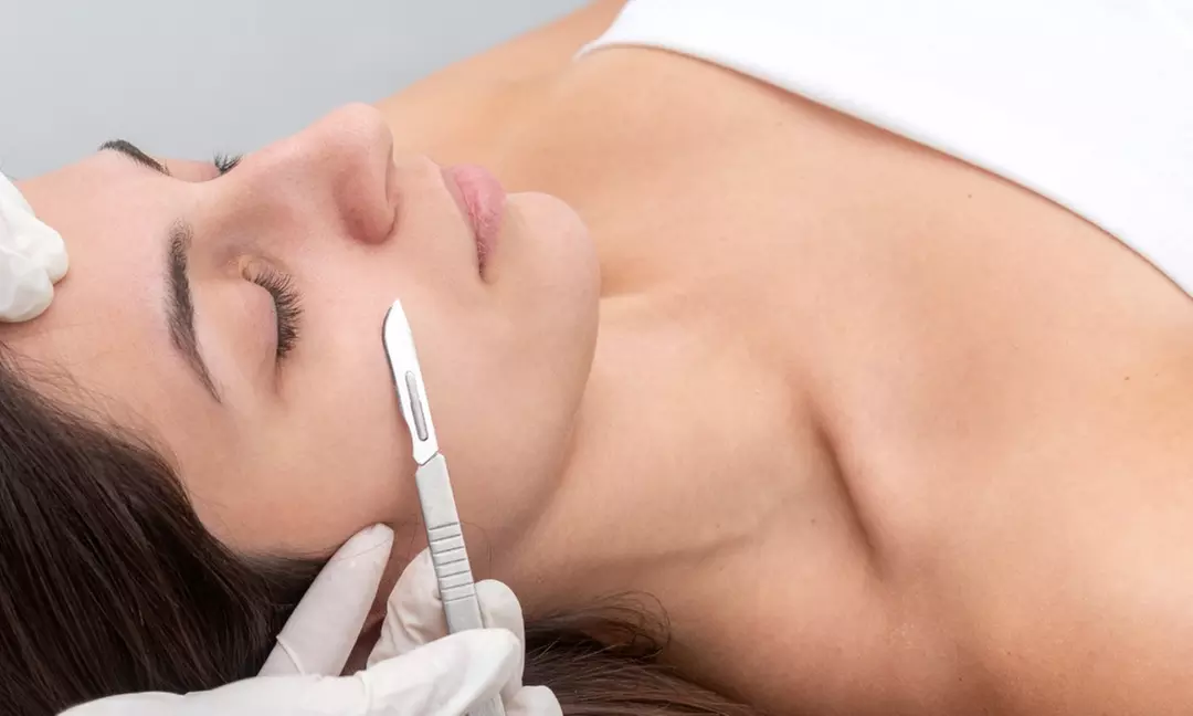 Up to 40% Off on Micro-Needling at UNIQUE STUDIO ROSS - Second Medium