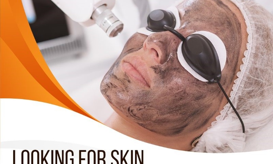 Image 1: Unleash Radiant Skin: Carbon China Doll Laser Facial