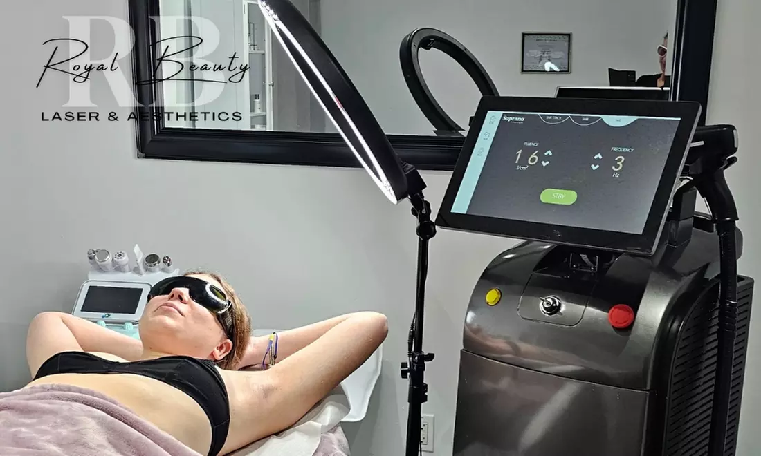 Up to 75% Off on Laser Hair Removal at Royal Beauty Laser & Aesthetics - Primary Image