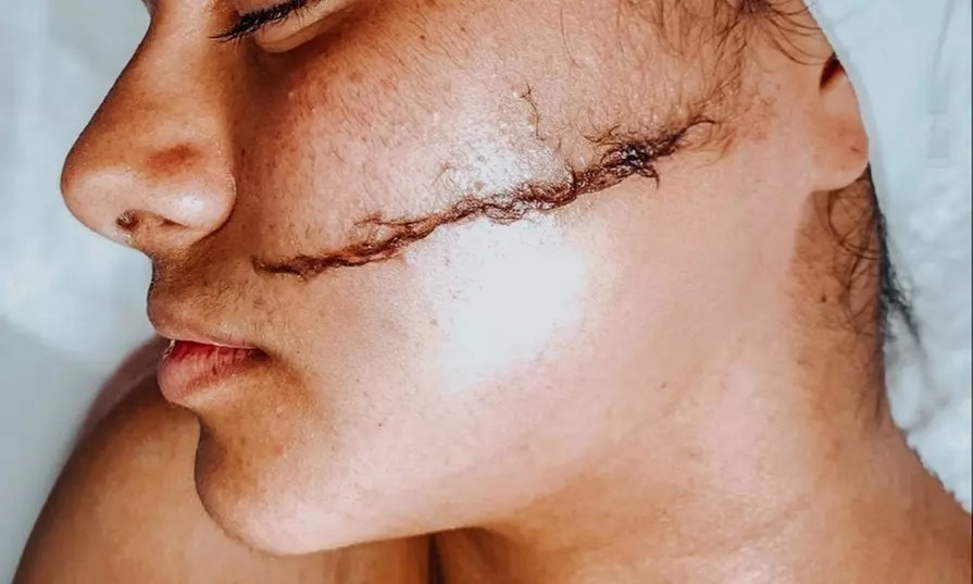 Experience a relaxing facial treatment of your choice