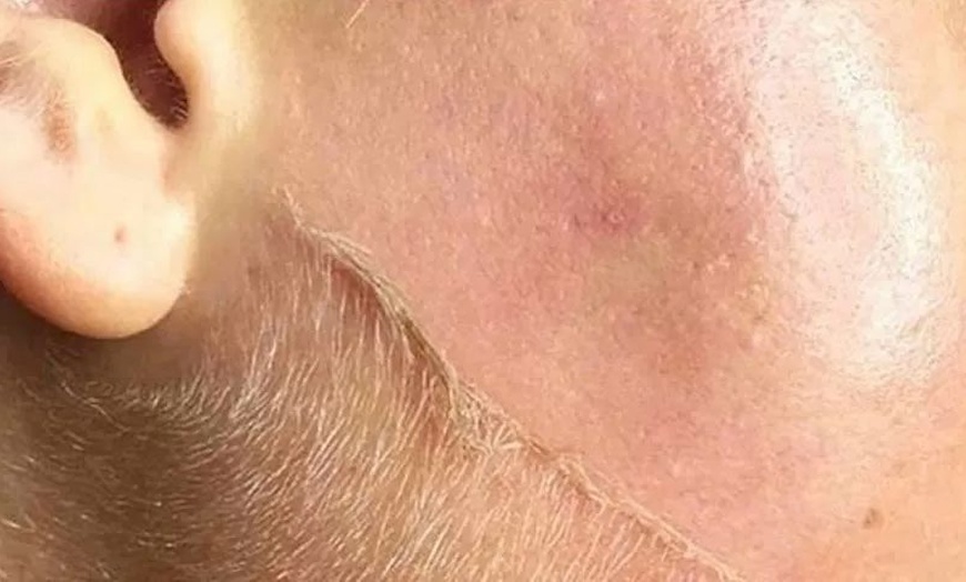 Image 1: 60-Min Dermaplanning w/ Chemical Peel & Optional LED Light Therapy