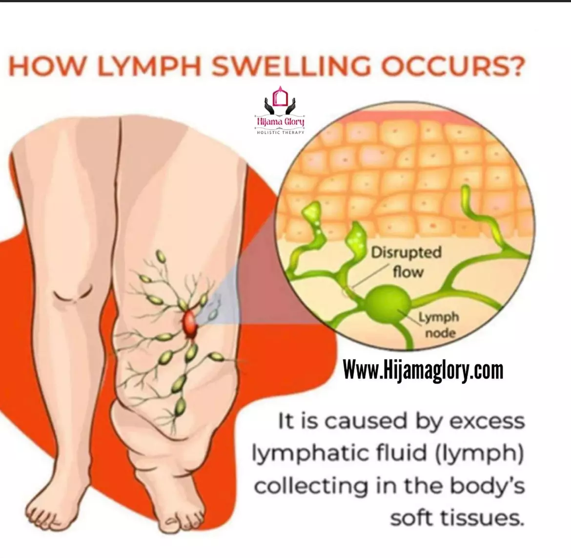 Up to 25% Off on Lymphatic Drainage Massage at Hijama Glory - Primary Image
