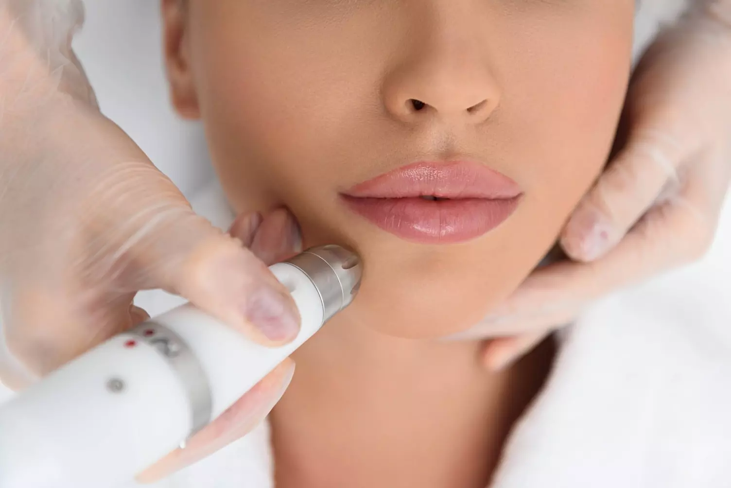 Up to 50% Off on Facial - Thermal Rejuvenation at Charette Cosmetics Medical Spa - Primary Image