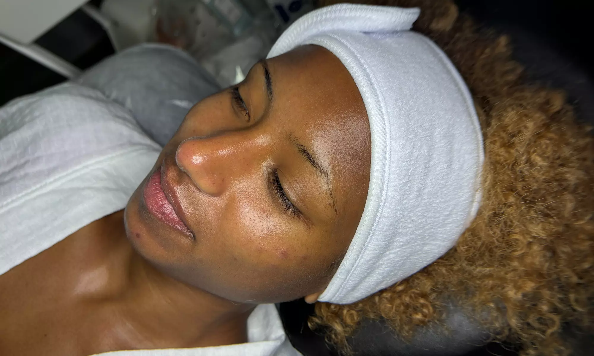 Experience a revitalizing HydraFacial at SoFlo Medical Center with add-ons, achieving radiant skin up to 50% off - Second Medium