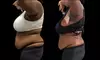 Up to 53% Off on Fat Reduction - Non-Branded at Southern Shapez
