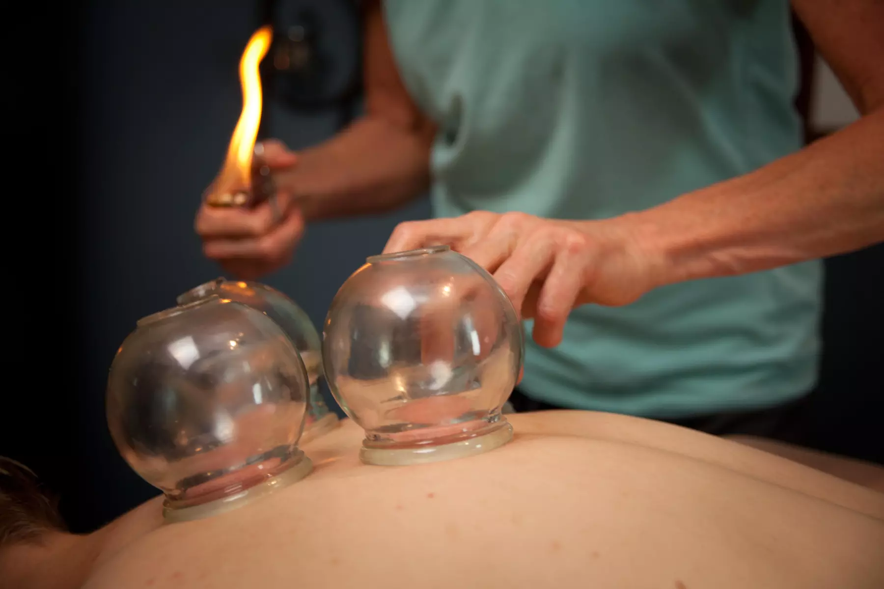 Up to 30% Off Acupuncture - Tailored Sessions with Award-Winning L.Ac